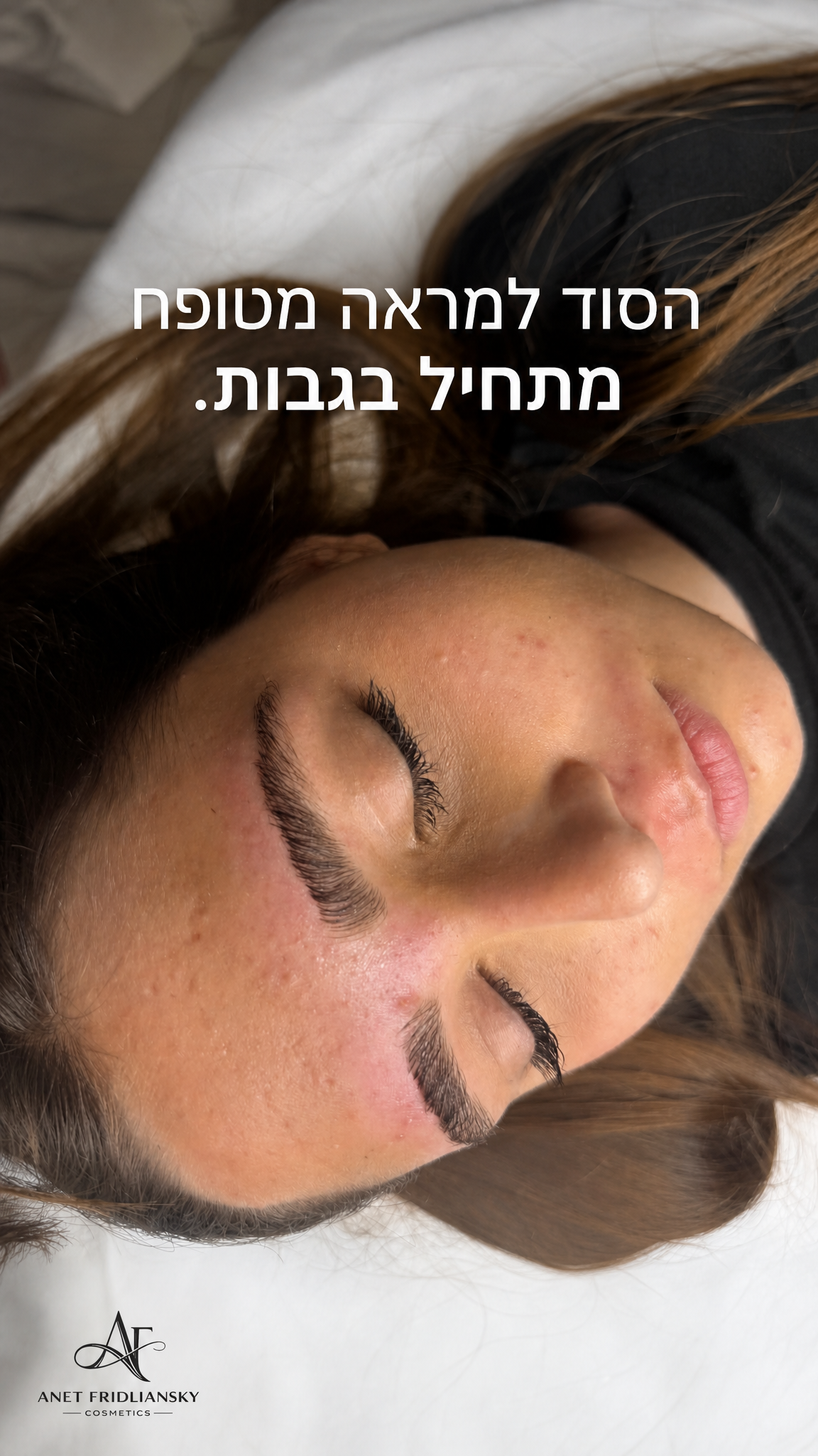 הסטורי היומי של anetcosmetics
