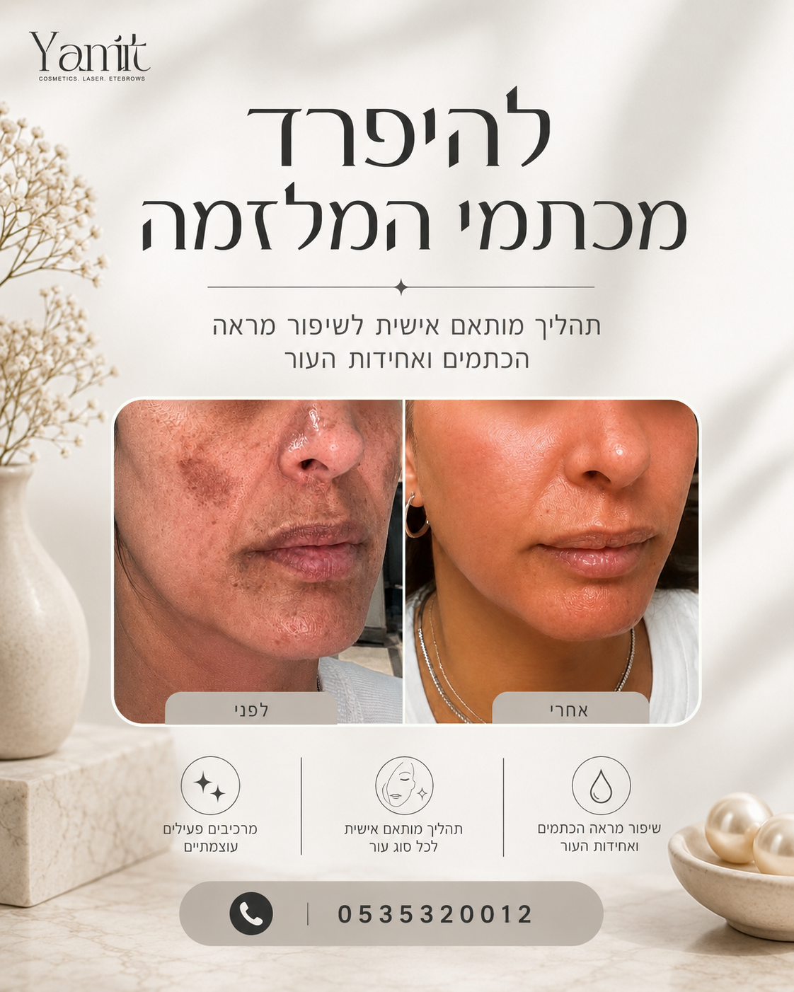 סובלות מכתמי מלזמה שמפריעים לכן לשגרת היום ומורידים את הביטחון? 😟 אני מבינה כמה זה יכול להיות מתסכל. מלזמה היא סוג של פ