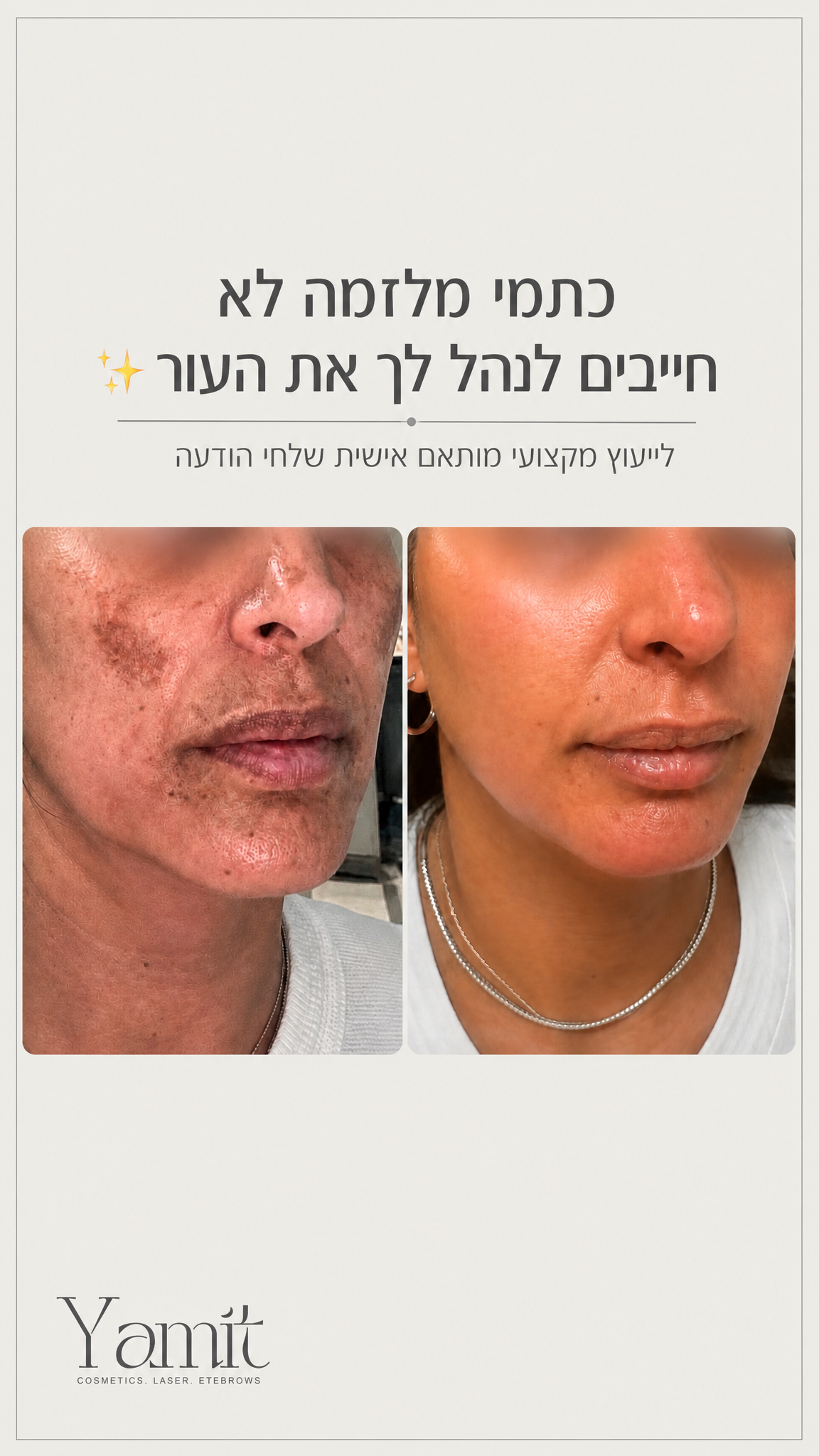הסטורי היומי של ימית עוזרי קוסמטיקה ויופי