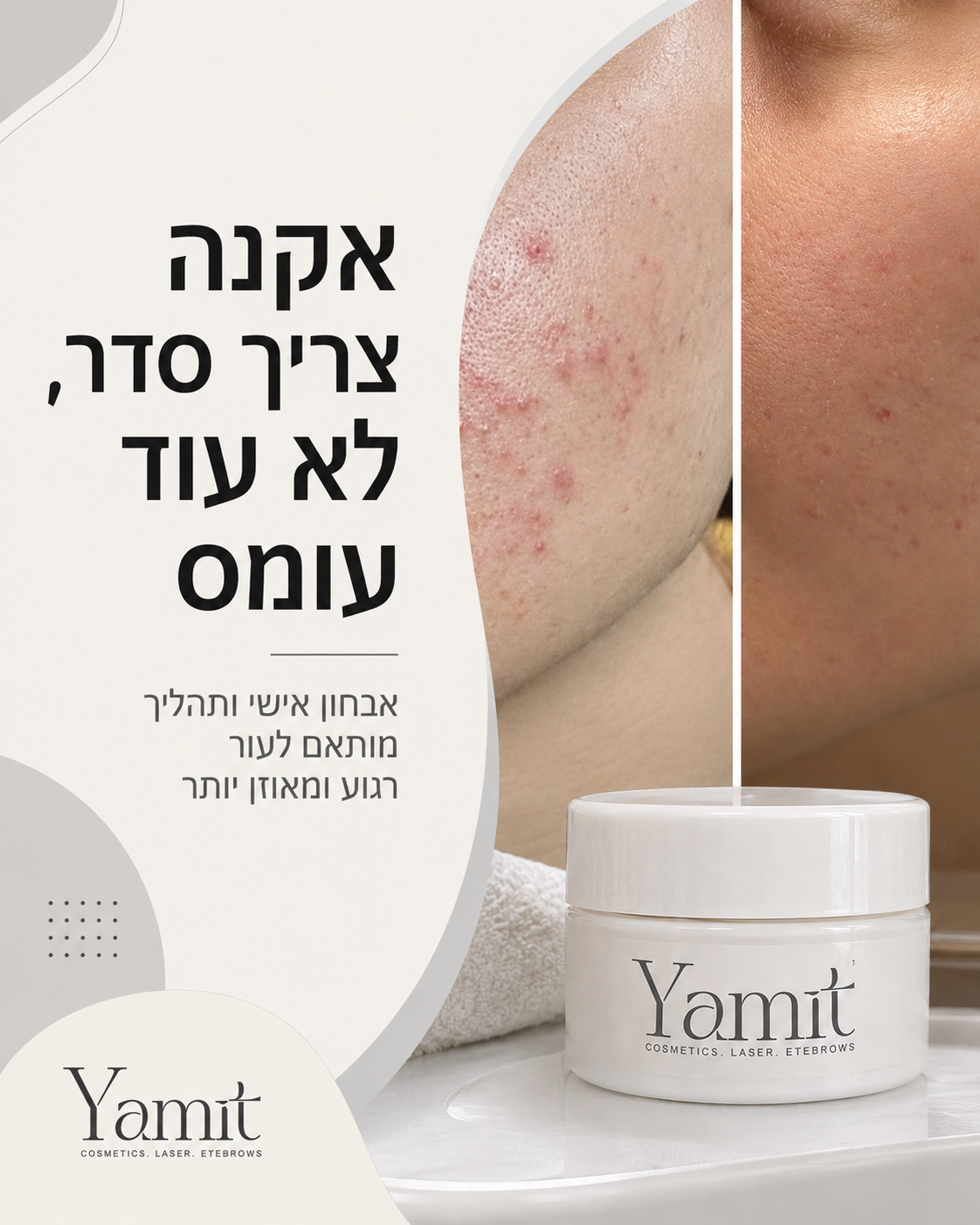 אקנה לא נרגע כשמחליפים כל שבוע מוצר! זה אחד הדברים שאני רואה הכי הרבה בקליניקה: לקוחה מגיעה עם תיק קטן ובפנים 7 תכשירים