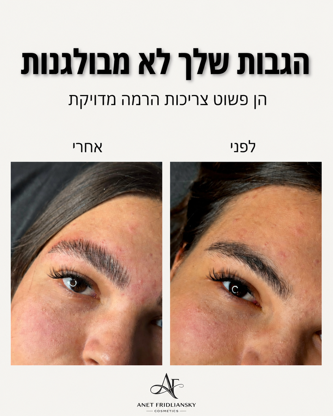 הבעיה הכי גדולה לפני הרמת גבות היא לא שהגבות לא יפות. הבעיה היא שהן לא תמיד יושבות בצורה שמחמיאה לפנים. שערות שיורדות למ