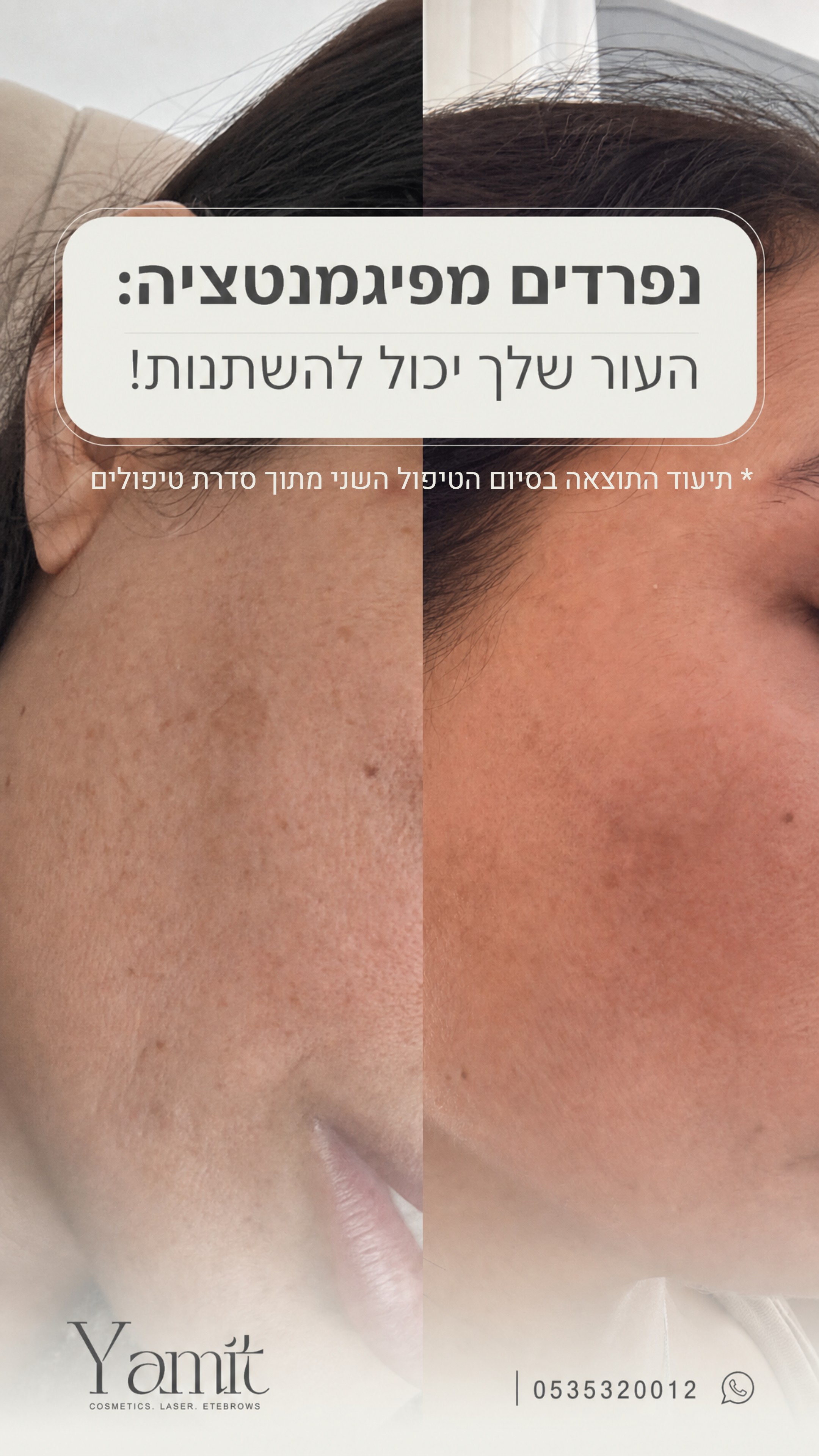 הסטורי היומי של ימית עוזרי קוסמטיקה ויופי