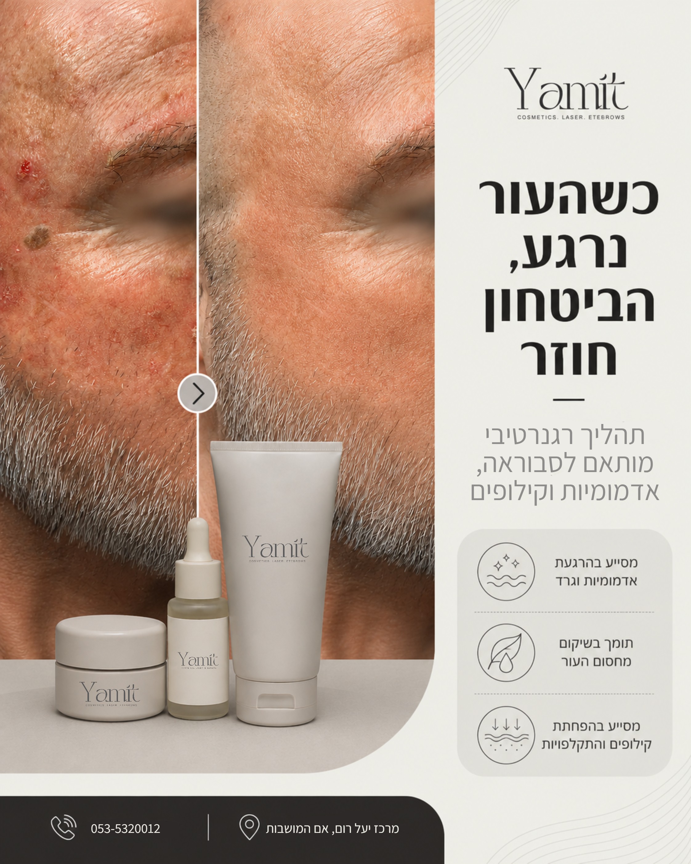 סבוראה לא צריכה לנהל לך את הביטחון 🌿 כשיש אדמומיות, קילופים, גרד ומרקם לא רגוע, העור בדרך כלל מבקש שיקום ולא עוד טיפול